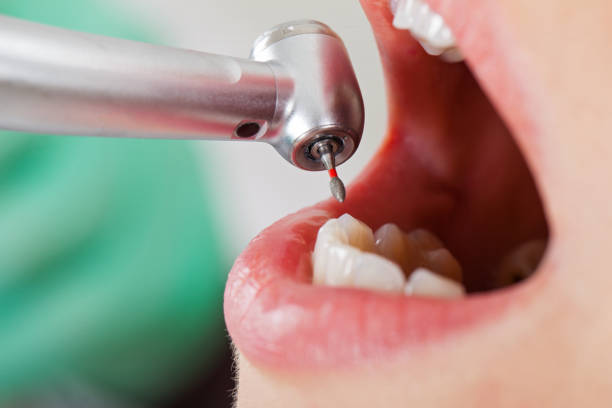 Best Pediatric Emergency Dentist in Tabor City, NC